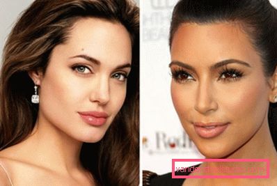 estrellas despues labio plastico